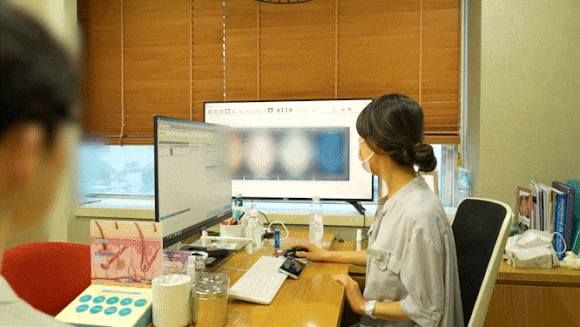피코플러스 레이저 장비로 피부 색소 치료를 하는 장면