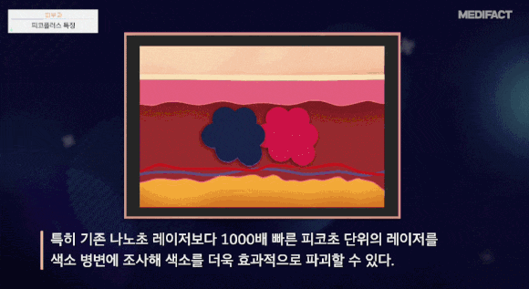 피코플러스 시술 후 피부 상태를 점검하는 모습