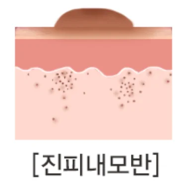 레이저 시술 장비와 상담실 전경