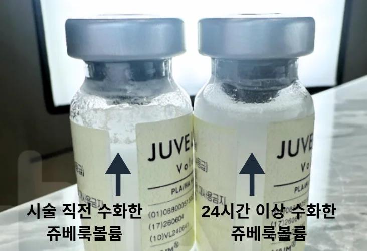 Hydration Comparison for Preventing Juvelook Volume Nodules