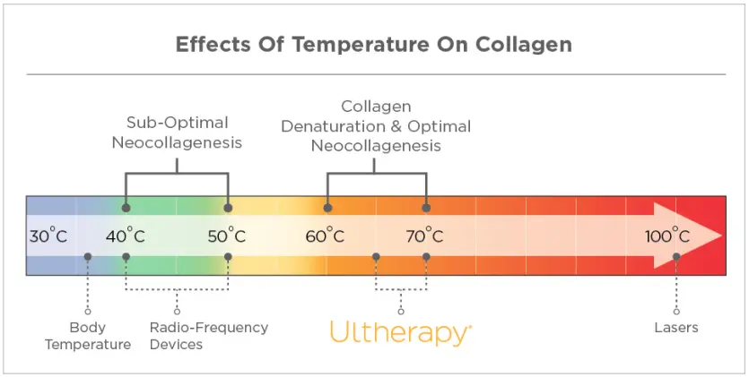 울쎄라 원리, 콜라겐 치유 과정