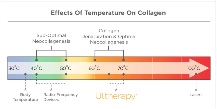 Ultherapy: Effects of Temperature on Collagen