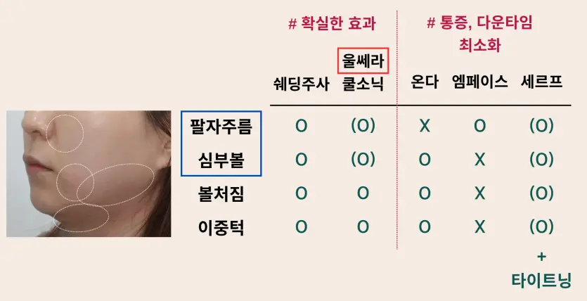 리프팅 시술 비교. 울쎄라 온다 엠페이스 세르프