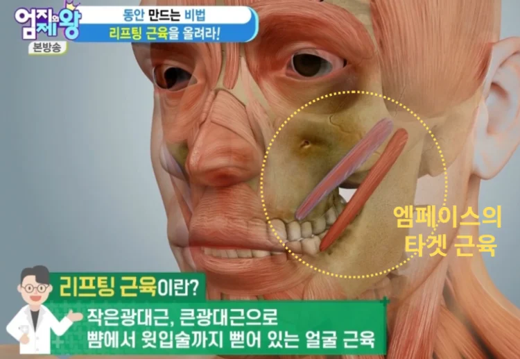 엠페이스의 주 타겟 근육은 광대근이다.