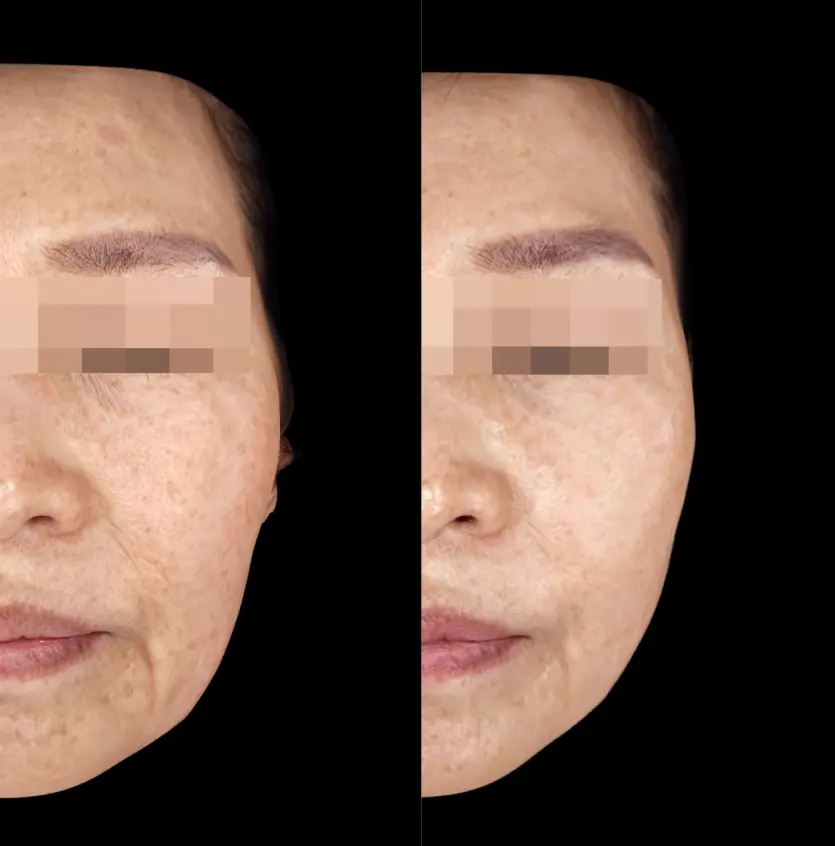 강남 오드의원 세르프 600샷 전후