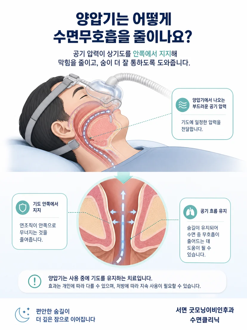 양압기 본체와 연결관 마스크를 통해 상기도로 공기가 전달되는 구조