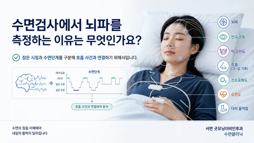 수면검사에서 뇌파로 잠든 시점과 수면단계를 확인하는 이유