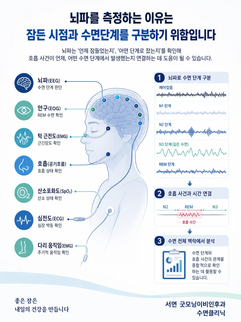뇌파와 안구 움직임 및 턱 근육 신호로 수면단계를 구분하는 원리