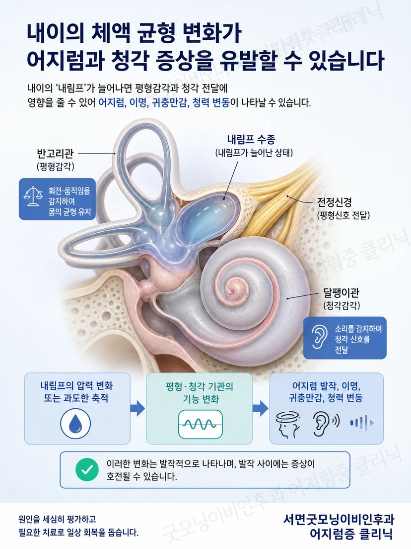내이의 균형과 청각 기능 및 내림프 수종 개념 설명 이미지