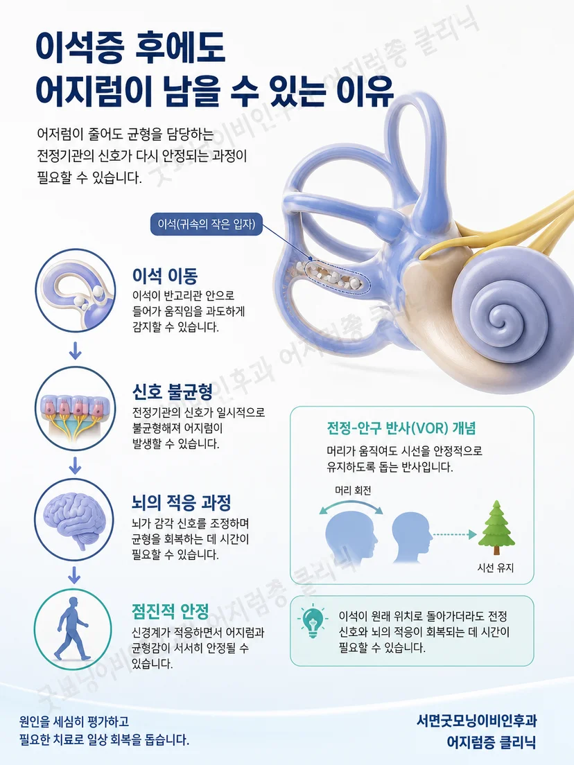 이석증 치료 후 균형 감각이 움직임에 다시 적응하는 과정