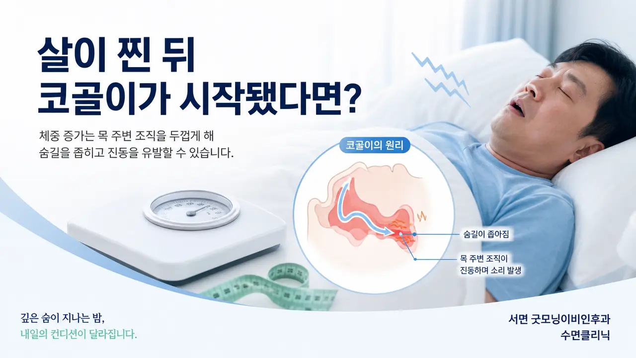 부산코골이 | 살이 찐 뒤 코골이가 시작됐다면 어떤 관련이 있나요?