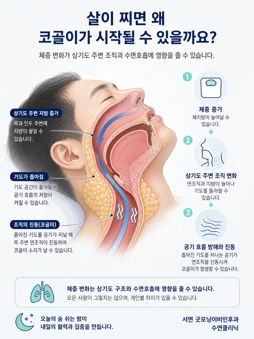 좁아진 상기도를 지나는 공기가 주변 조직을 진동시키는 원리
