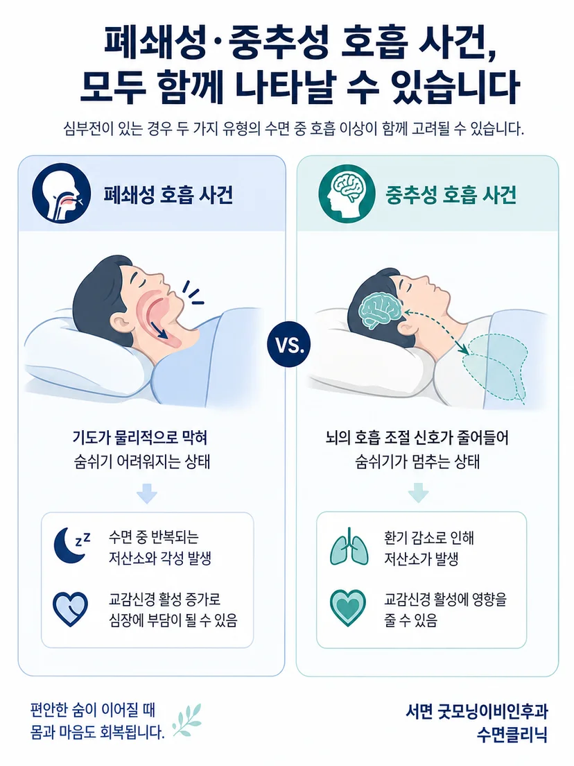 폐쇄성 호흡 사건과 중추성 호흡 사건의 차이 설명