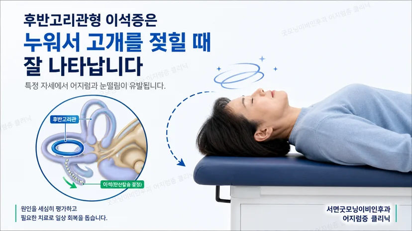 후반고리관형 이석증이 잘 유발되는 머리 자세 설명