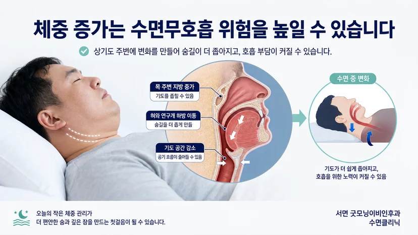 체중 증가가 수면 중 상기도와 호흡에 미치는 영향을 설명하는 그림