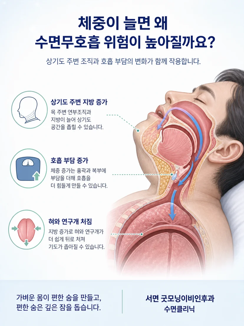 혀와 연구개 및 상기도 단면이 수면자세에 따라 달라지는 해부학 설명 그림