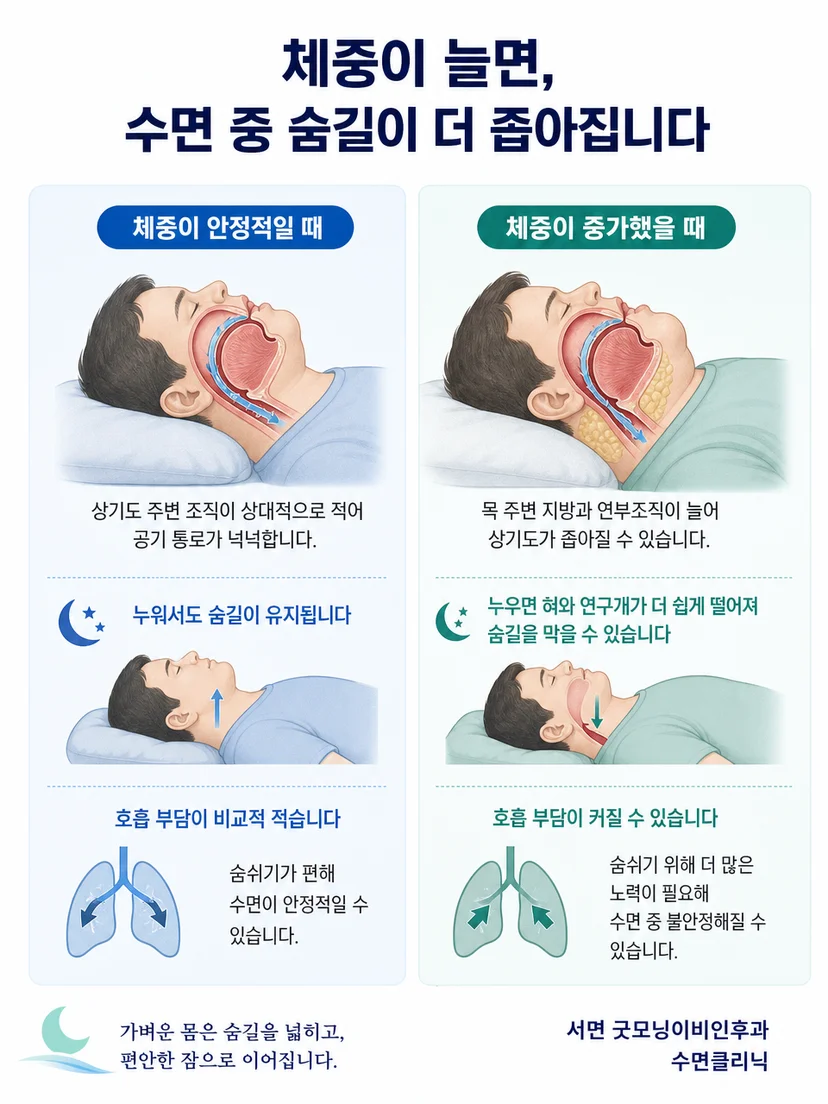 체중 증가라는 위험요인과 수면무호흡 진단을 구분하는 설명 그림