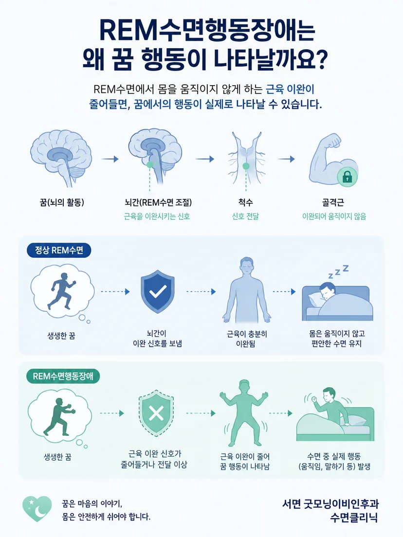 REM수면의 정상적인 근육 이완과 꿈 행동 발생 원리