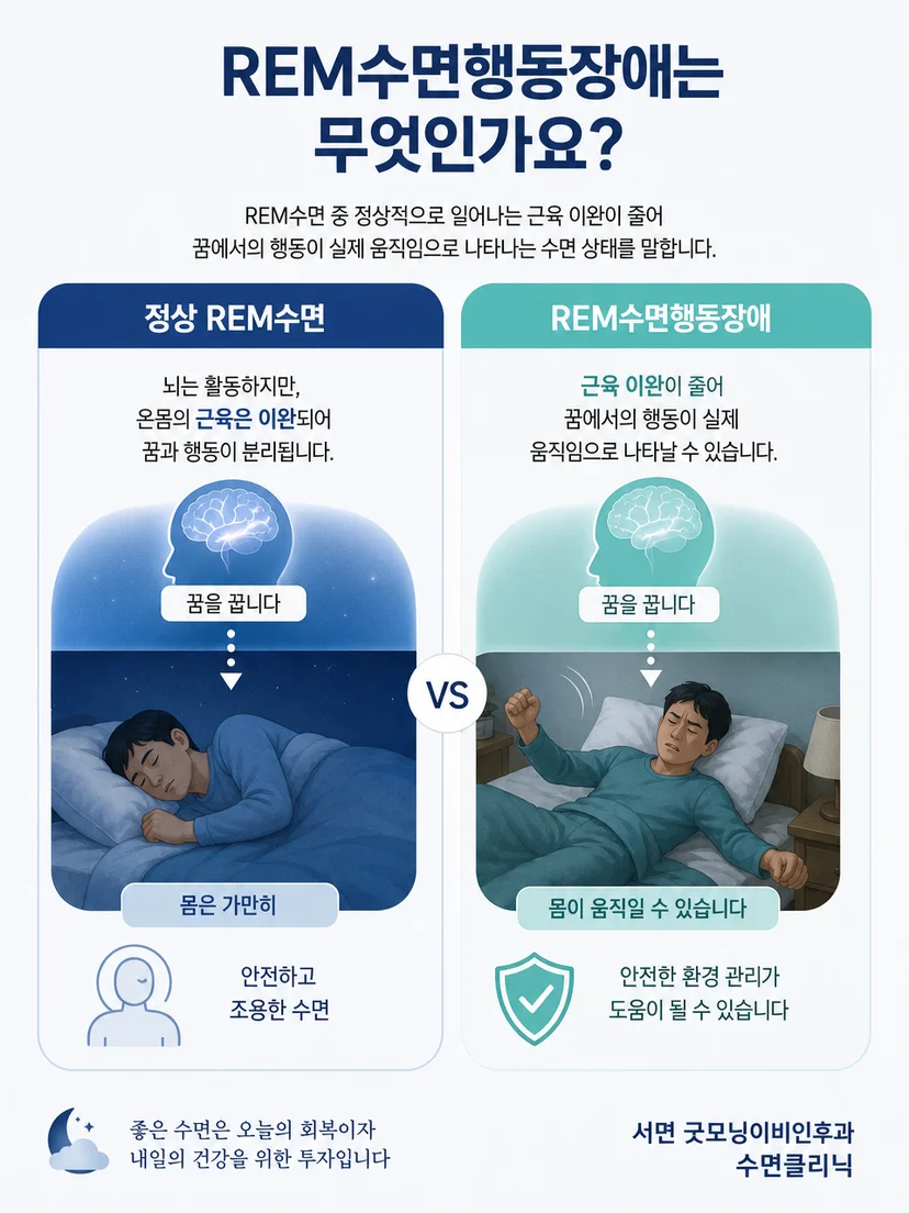 수면 단계에 따른 잠꼬대와 꿈 행동의 차이