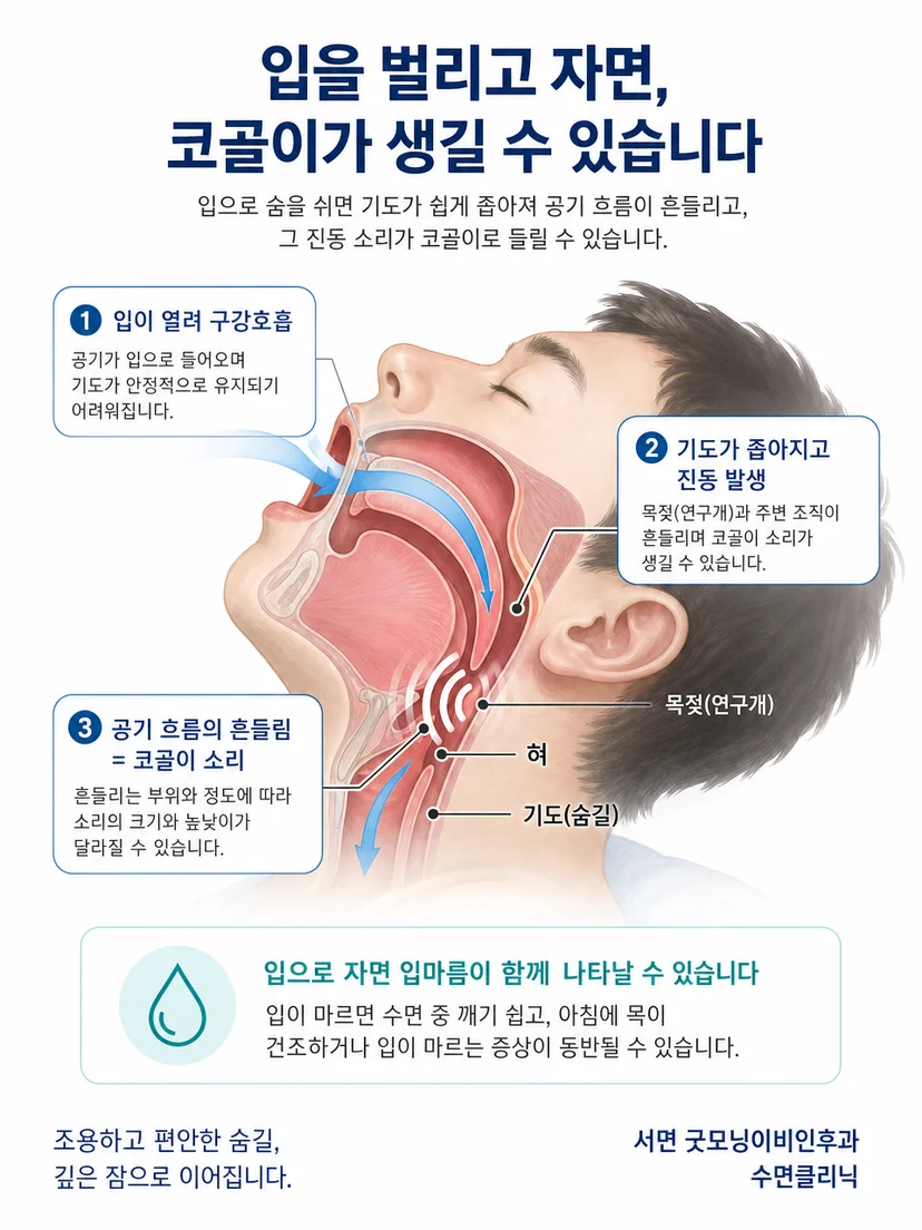 좁아진 상기도를 지나는 공기와 코골이 진동 원리
