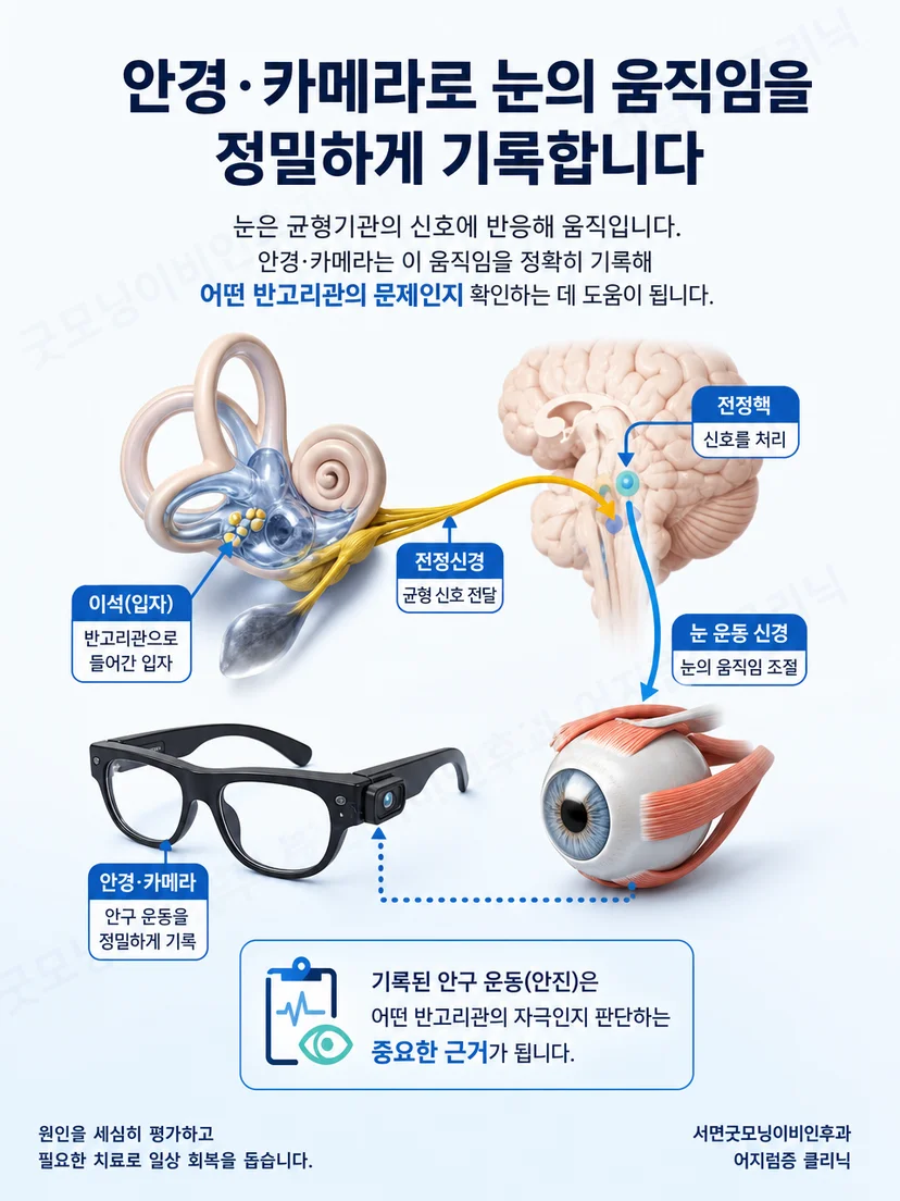 자세 변화와 반고리관 자극에 따라 나타나는 안진의 원리
