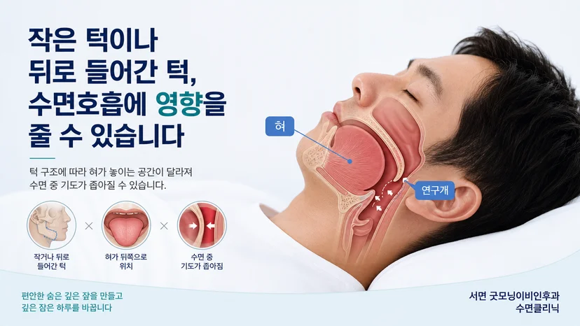 작은 턱과 수면 중 공기 통로의 관계를 설명하는 그림