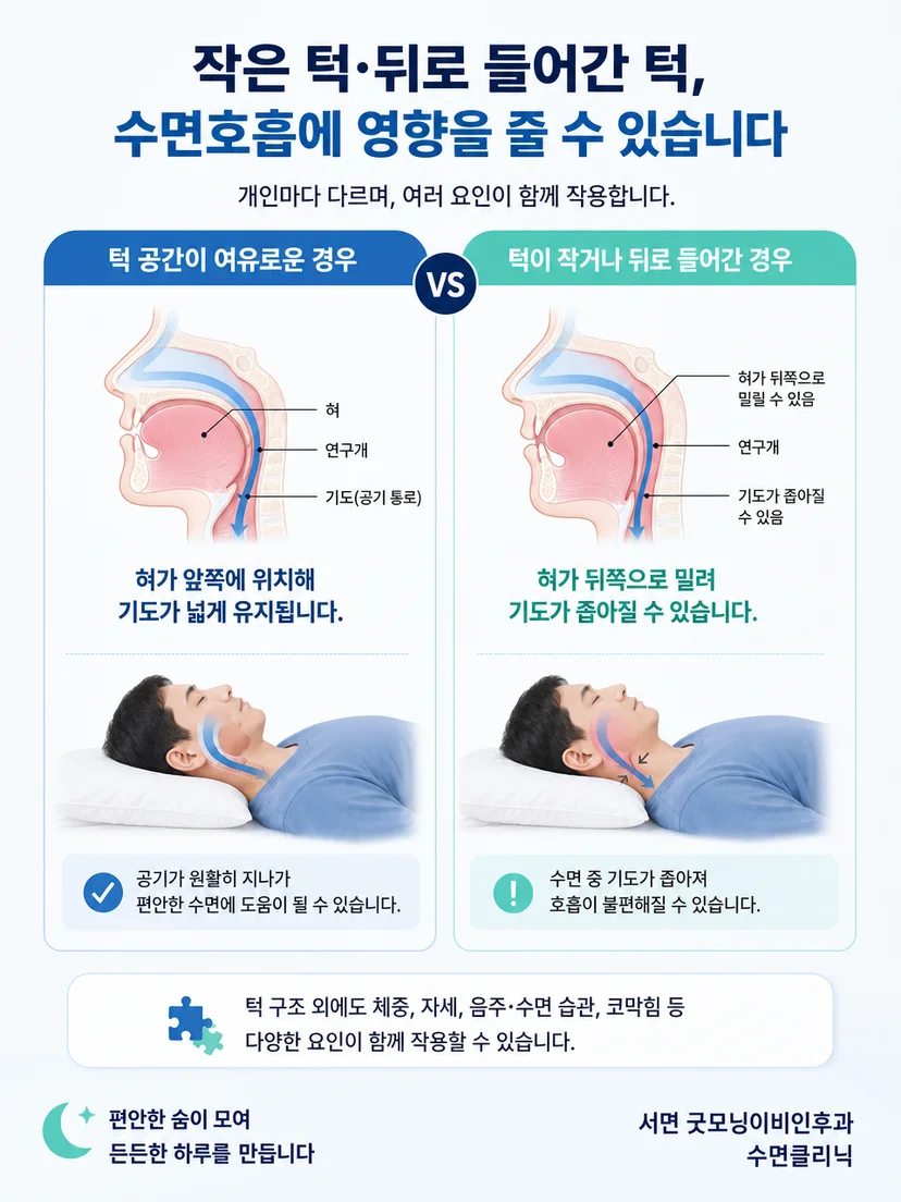 턱 모양은 위험요인이지만 진단 자체는 아니라는 주의점