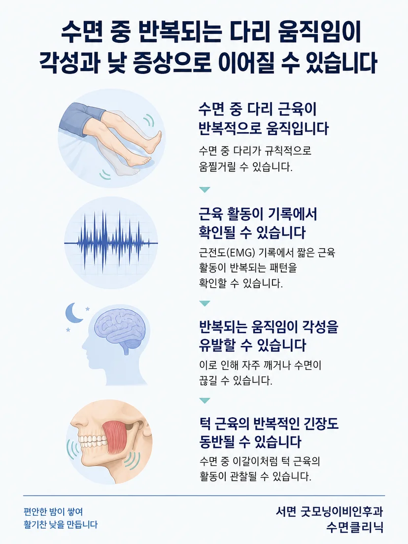 다리 근전도 변화와 수면 각성의 시간 관계를 보여주는 설명 그림