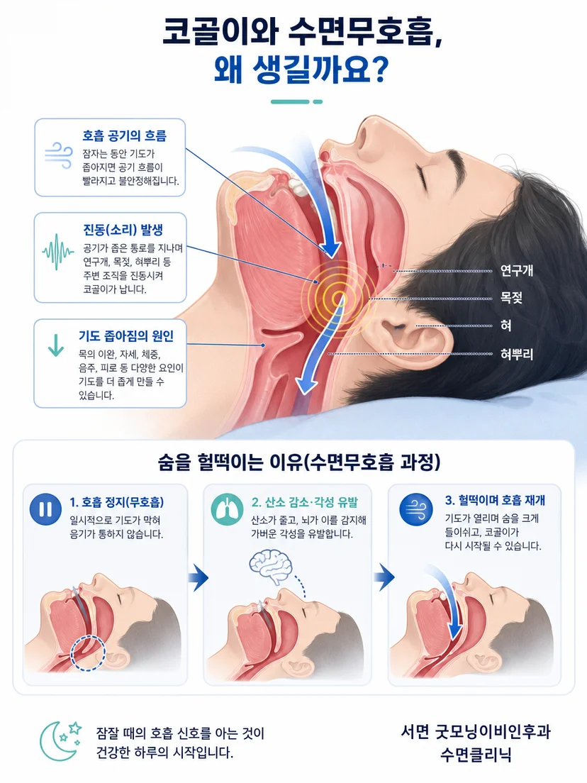 수면 중 좁아진 기도에서 조직 진동과 공기 흐름 변화를 설명한 그림