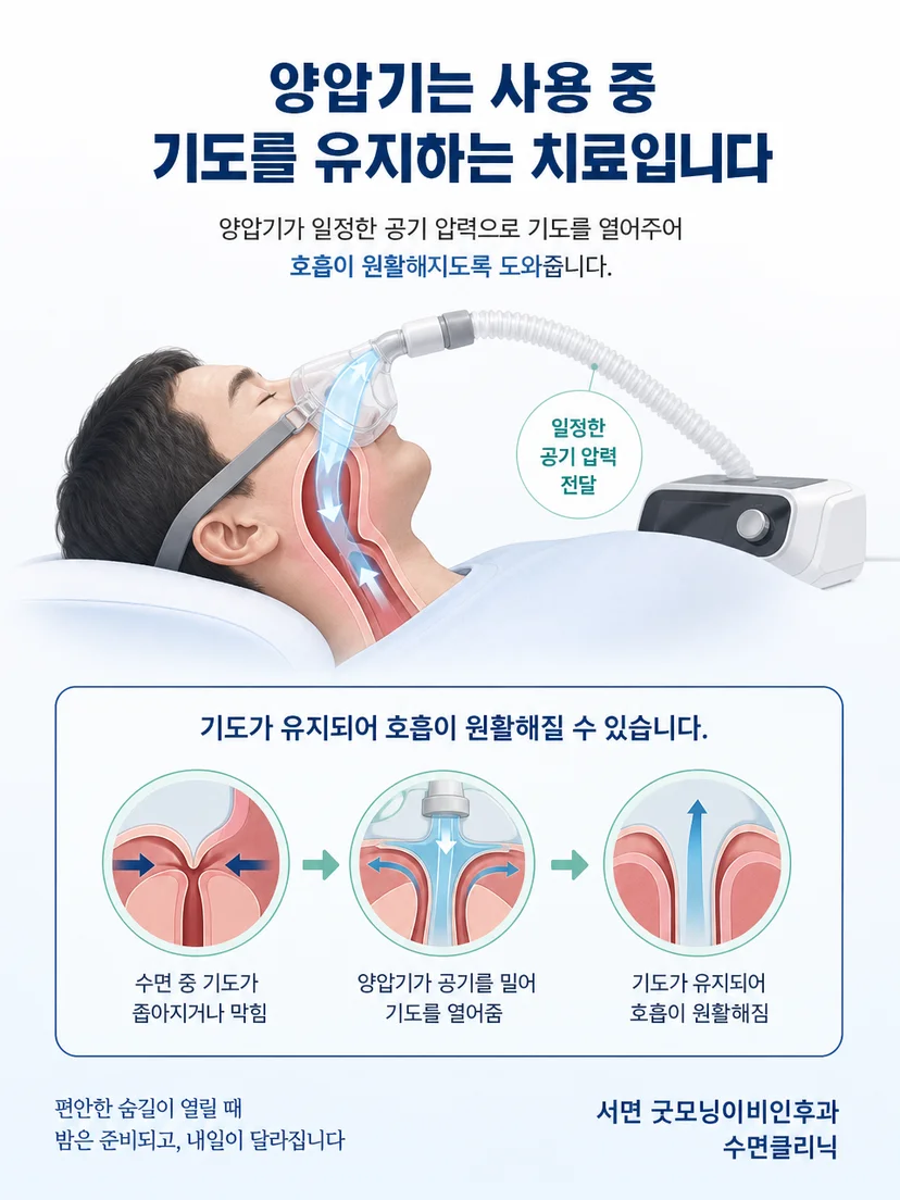 마스크와 양압기가 연결되어 기도에 압력을 전달하는 구조