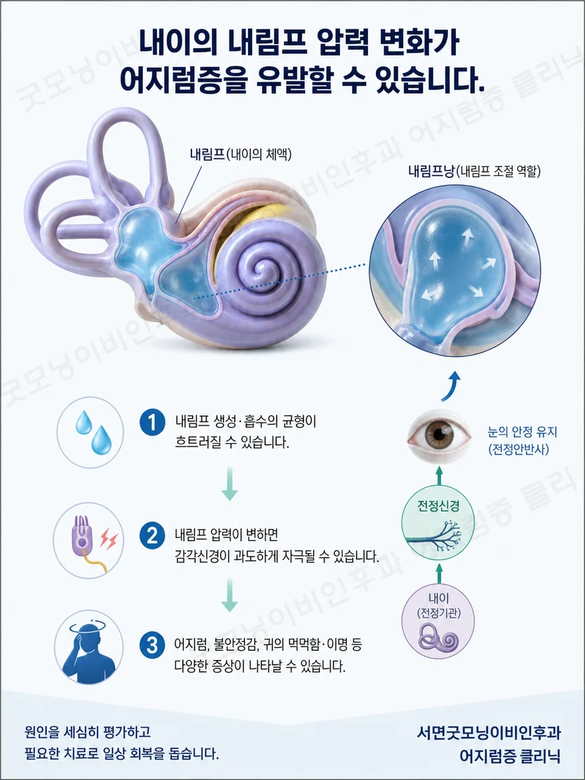 내이 기능과 생활 요인의 복합적인 관계를 설명하는 그림