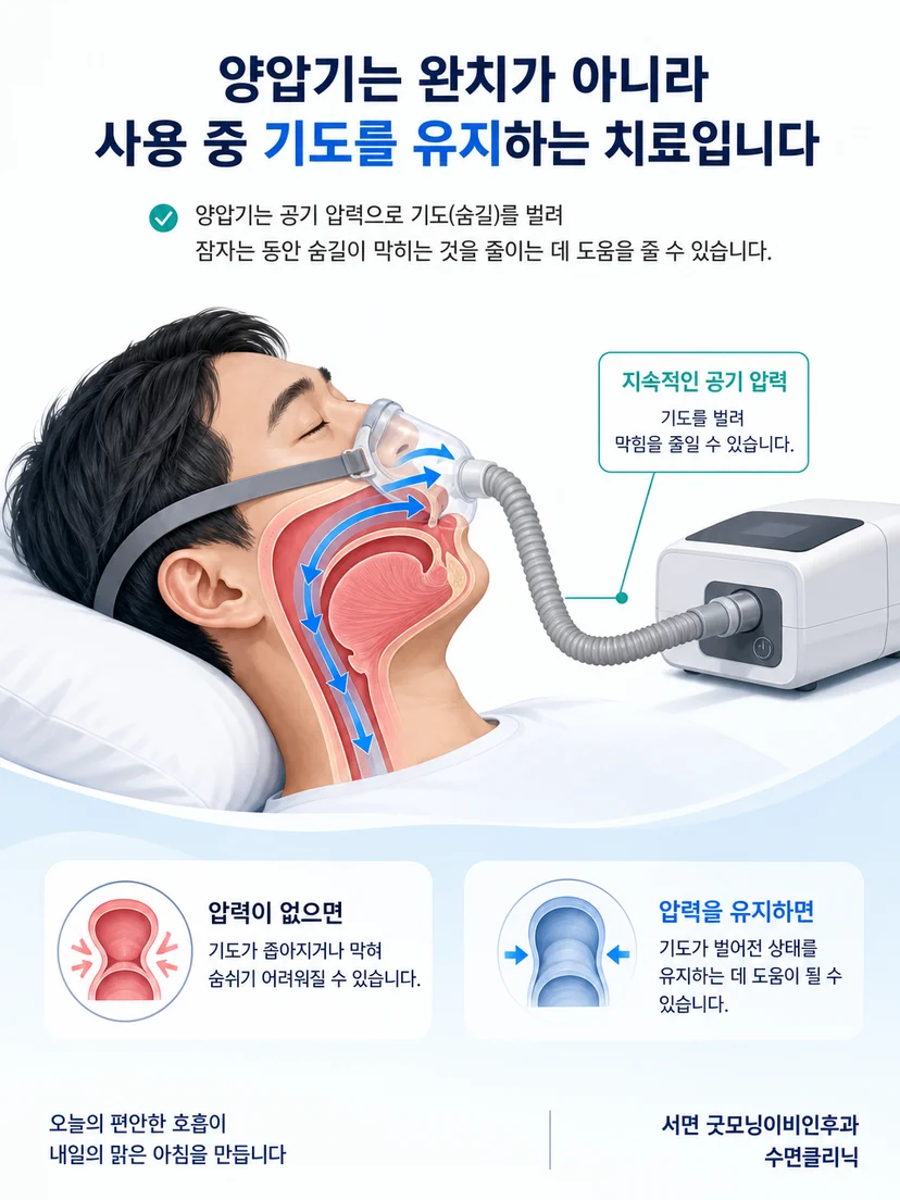 마스크를 통해 전달된 공기 압력이 기도를 지지하는 원리