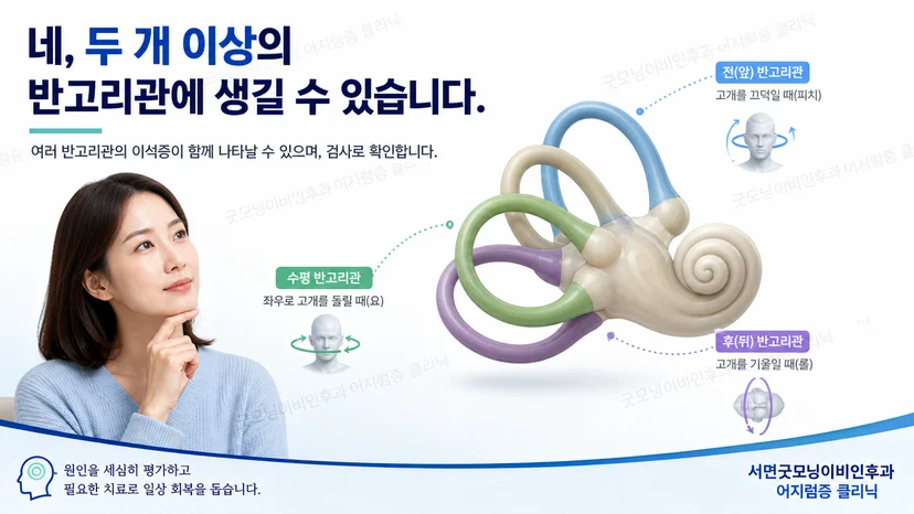 두 개 이상의 반고리관에 발생할 수 있는 복합 이석증 핵심 설명