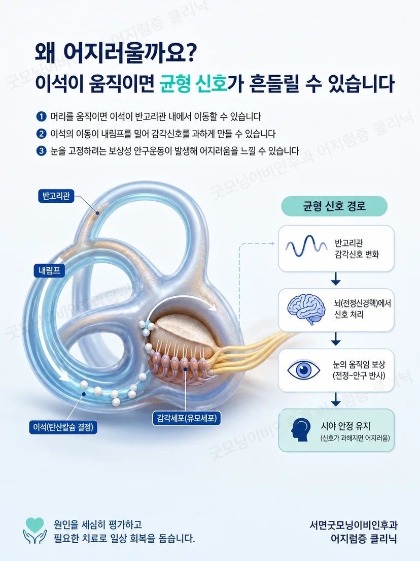 뒤 수평 앞반고리관의 공간 방향을 보여주는 삼차원 내이 도식