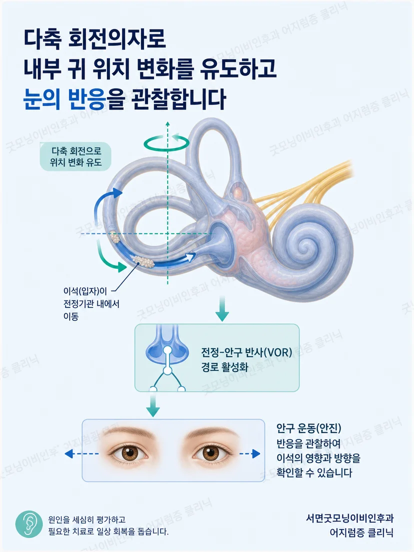 다축 회전으로 진단 자세를 재현하는 원리를 나타낸 단순 의료 도식