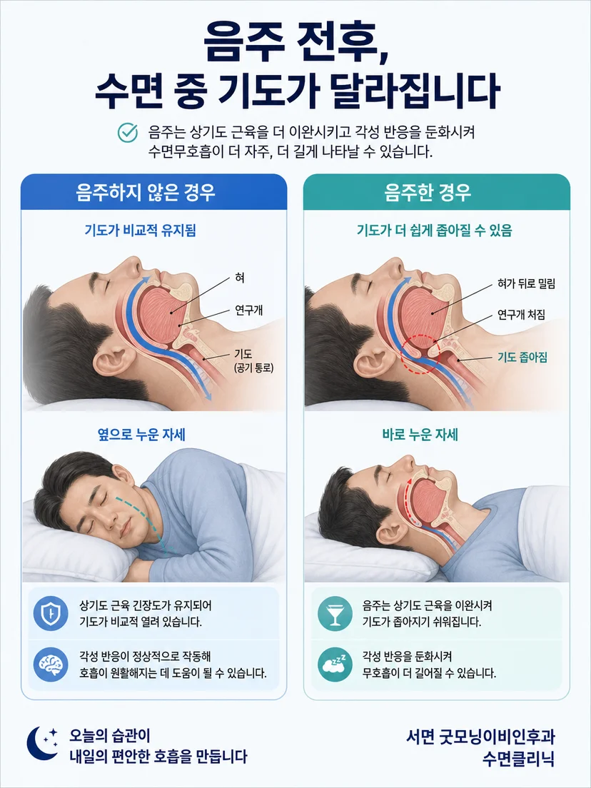 음주 후 관찰할 수 있는 수면 호흡의 주요 단서와 주의점