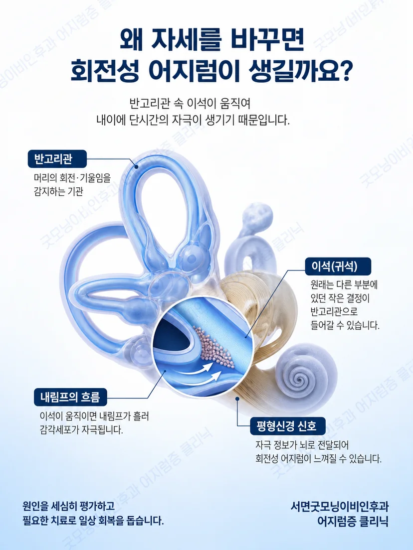 머리 위치 변화와 내이 반고리관 자극의 관계를 보여주는 설명 이미지