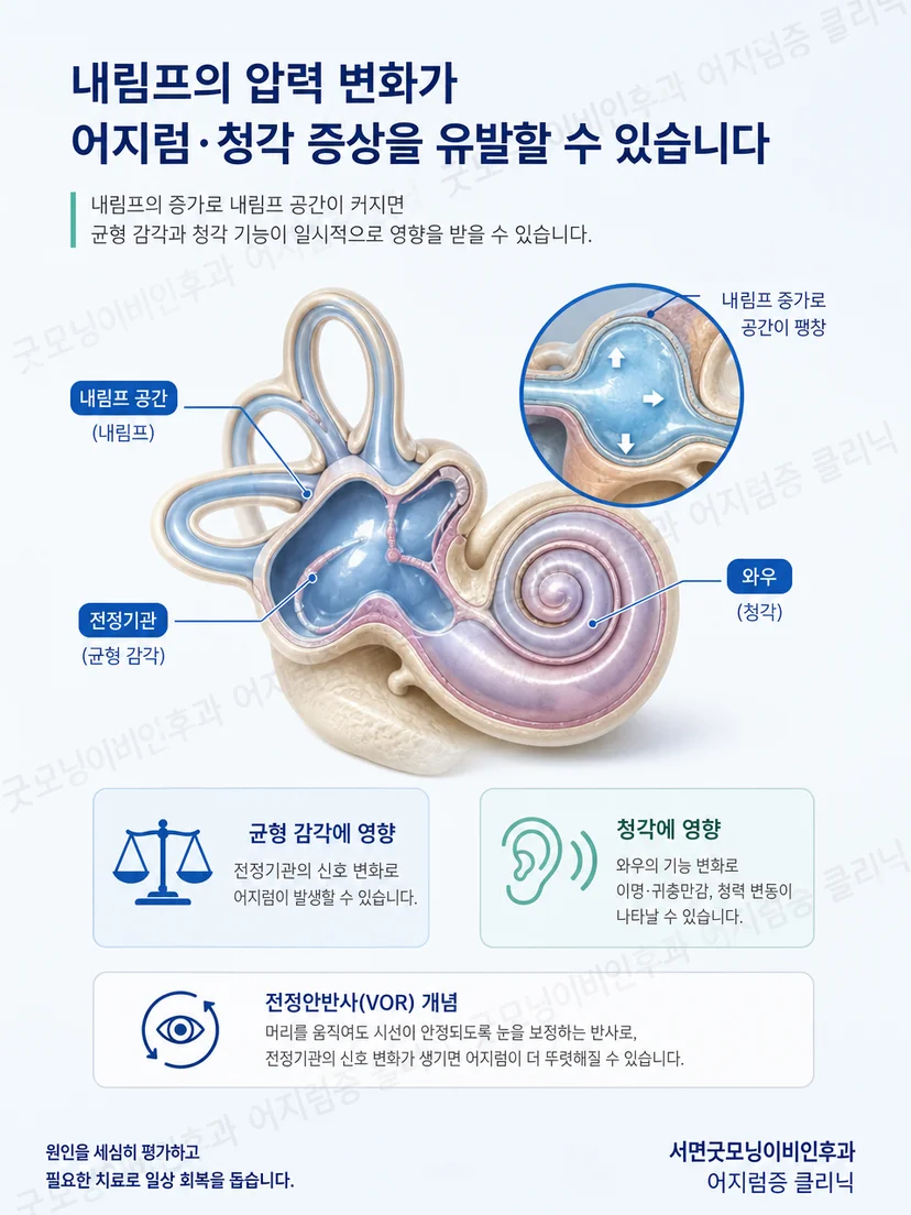 내이의 평형과 청각 기능이 함께 관련되는 메니에르병 개념