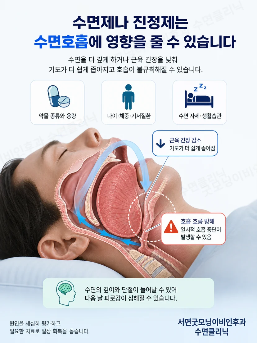 누운 자세에서 혀와 연구개 주변 상기도가 좁아지는 원리