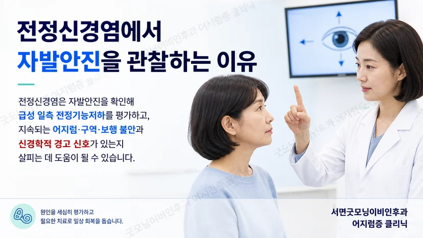 전정신경염에서 자발안진을 관찰하는 핵심 이유를 설명하는 그림