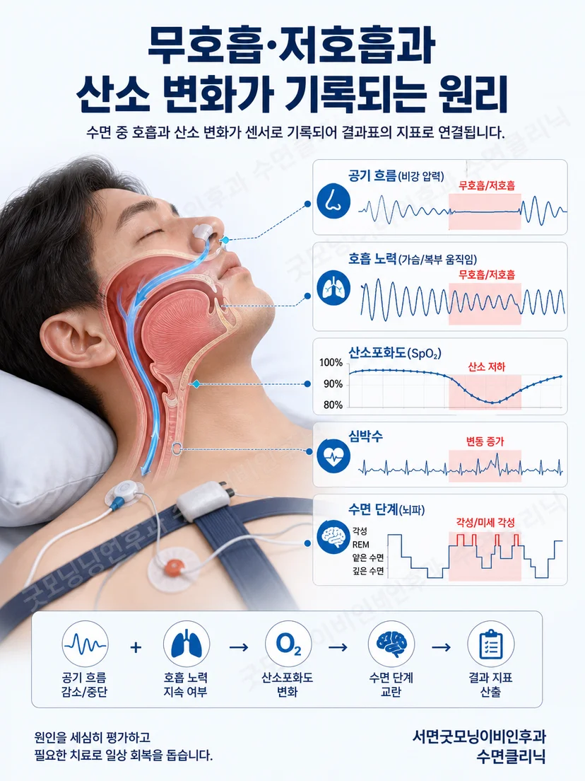 수면 중 기류 호흡 노력 산소 변화가 시간에 따라 기록되는 원리