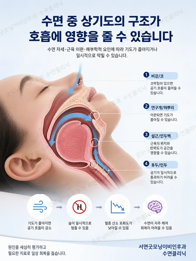 코와 인두 및 혀뿌리 주변 상기도 구조를 설명하는 그림